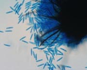 Spore black dot Spore black dot