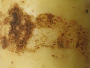 Rhizoctonia corky lesions 